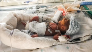 Ontario mom shares incredible survival story of baby born at size of a marker